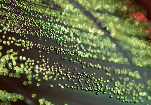 After weight-loss surgery, new gut bacteria keep obesity away